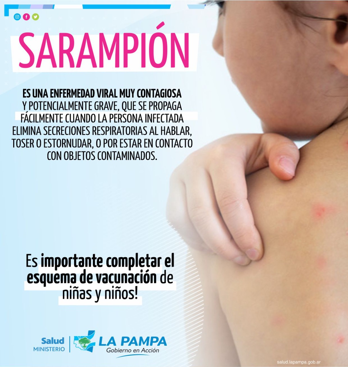 Nación confirma un caso de sarampión: se reafirma la importancia de completar los calendarios de vacunación  